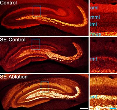 Signaling Pathways and Cellular Mechanisms Regulating Mossy Fiber Sprouting in the Development of Epilepsy